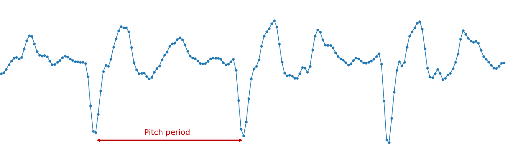 LPC model